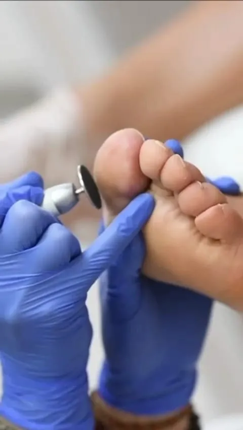 Foto del trattamento Pedicure con Micromotore